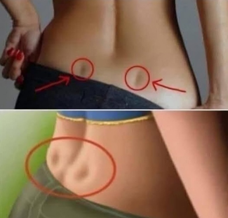 Біль у попереку: чому у мене болить поперек?