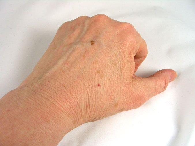 А ви знали, що якщо на руках з’являються схожі плями, то це явна ознака того, що…